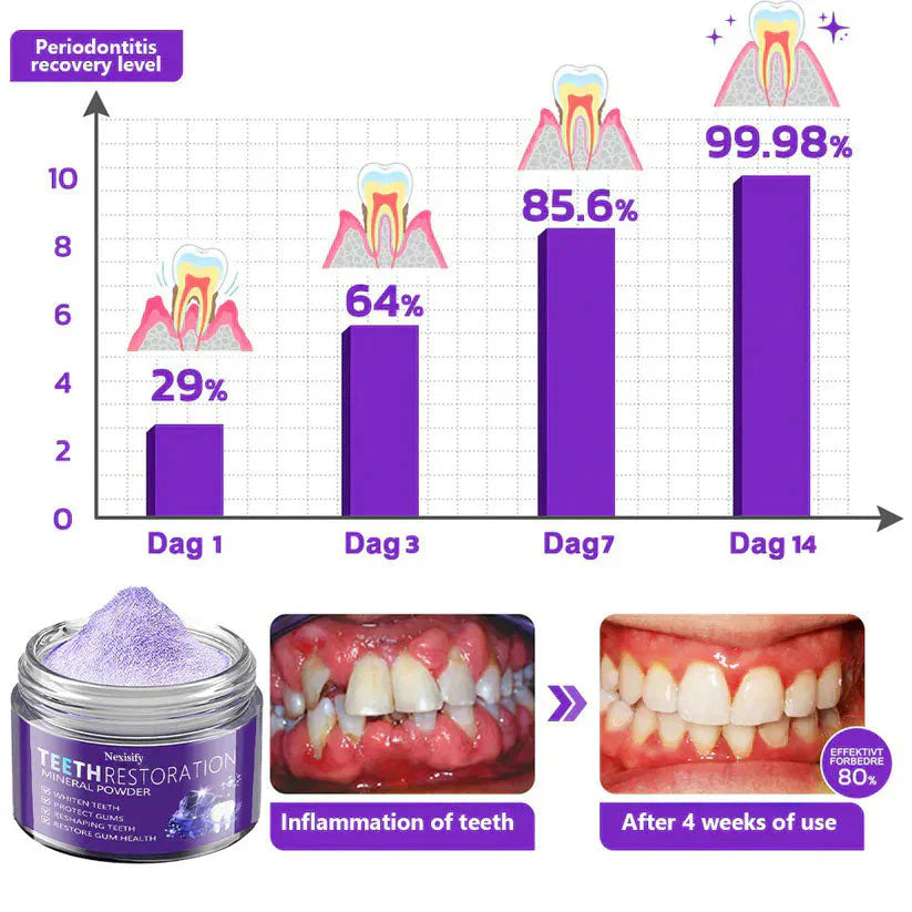 🦷Nexisify™ Dental Repair Mineral Powder >> 🔥Buy 1 Get 1 Free🔥