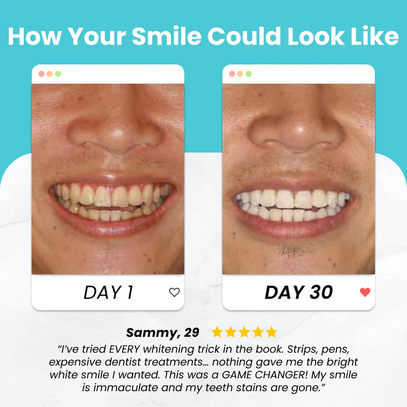 đ„Limited Time 60% OFFđ„ Electric U Shaped Toothbrush Rechargeable Sonic