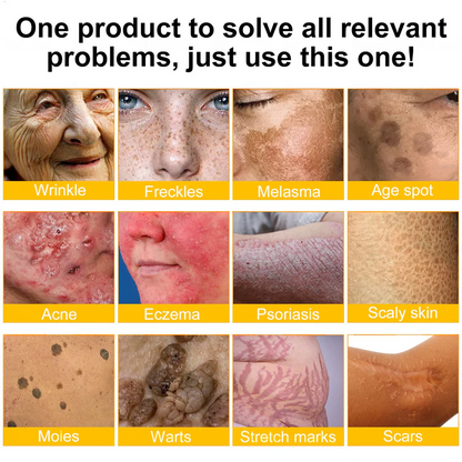 ✨✨✨FDA Approved: LOVILDS® Bee venom Pro Comprehensive Cream — 🔥Limited Time 80% OFF🔥