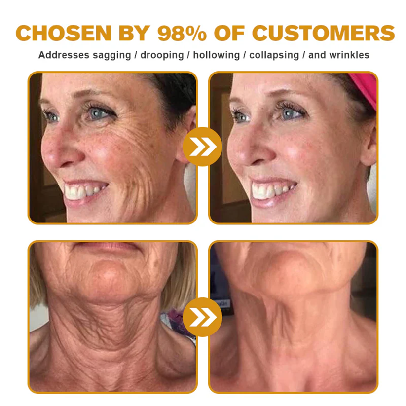 ✨✨✨FDA Approved: LOVILDS® Bee venom Pro Comprehensive Cream — 🔥Limited Time 80% OFF🔥