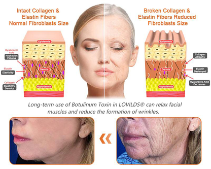✨✨✨FDA Approved: LOVILDS® Bee venom Pro Comprehensive Cream — 🔥Limited Time 80% OFF🔥