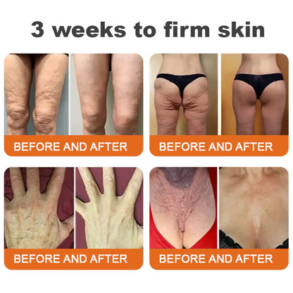 ✨✨✨FDA Approved: LOVILDS® Bee venom Pro Comprehensive Cream — 🔥Limited Time 80% OFF🔥