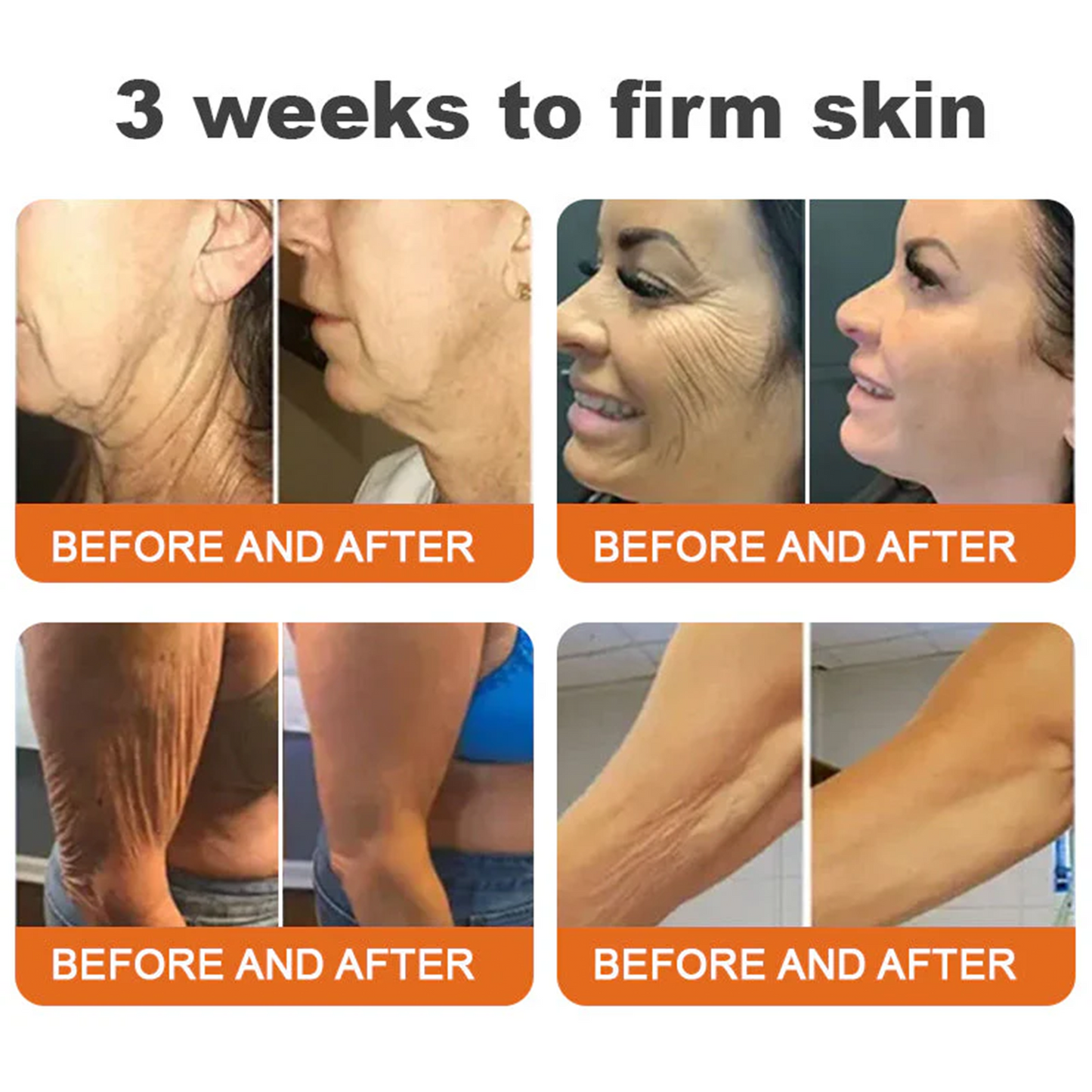 ✨✨✨FDA Approved: LOVILDS® Bee venom Pro Comprehensive Cream — 🔥Limited Time 80% OFF🔥