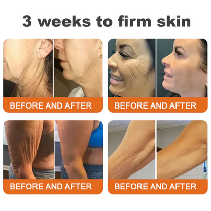 ✨✨✨FDA Approved: LOVILDS® Bee venom Pro Comprehensive Cream — 🔥Limited Time 80% OFF🔥